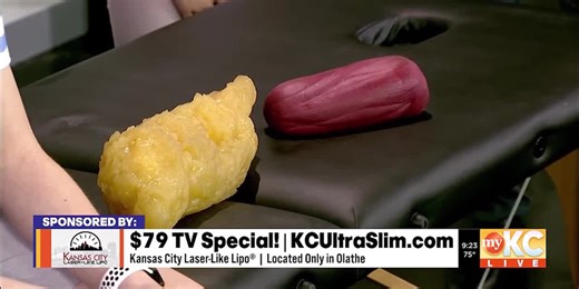 KC Laser-Like Lipo UltraSlim