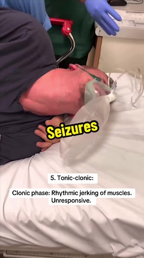 Understanding 5 Types of Seizures: Medical Insights