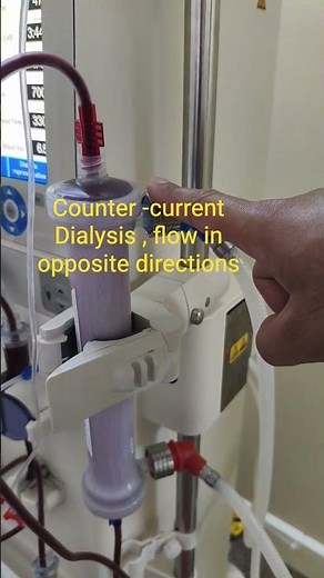 counter current dialysis | fresenius 4008s machine #kidneyhealth