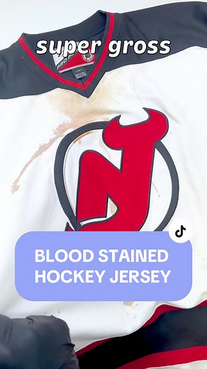 This is a dry cleaners guide to removing old blood stains. Thank you to my friends for constantly buying me heavily soiled garments to see if I can get them out! First, old blood stains will require hydrogen peroxide to break down the stain. I started with 12% and quickly moved to 35% since these were so incredibly bad. Quick shout out to bulk peroxide for hooking me up with some new peroxide concentrations ! Put a towel behind your stain to ensure the stain doesn’t transfer to another part of t