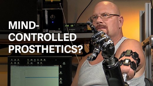 49K views · 912 reactions | This person is using mind control to move a robotic hand, right down to its individual fingers. It could be a major breakthrough in prosthetics. | Quartz | Facebook