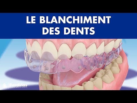 Blanchiment dentaire ©