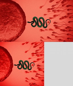 Fertility Doctors Used Their Sperm to Get Patients Pregnant. The Children Want Justice