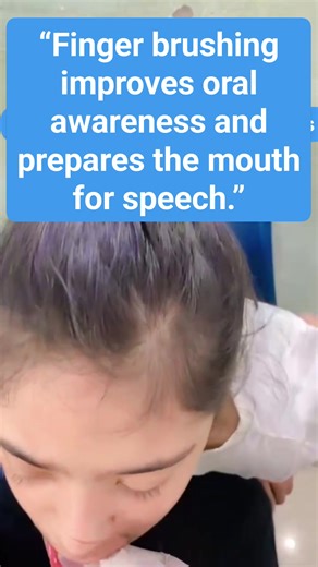 🪥 Why Do We Use a Finger Brush? A finger brush is used in therapy and daily care to support oral awareness, sensory regulation, and speech readiness. ✅ 1. Improves Oral Sensory Awareness Gentle brushing helps the child feel their lips, gums, and tongue, which is important for speech sounds and feeding skills. ✅ 2. Helps Reduce Oral Sensitivity Many children avoid textures in the mouth. A finger brush provides deep pressure input, helping reduce gagging and oral defensiveness. ✅ 3. Prepares Mout