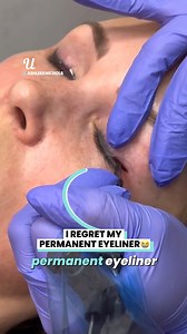 45K views · 25 reactions | Finally fixing my huge mistake | Ultimate | Facebook