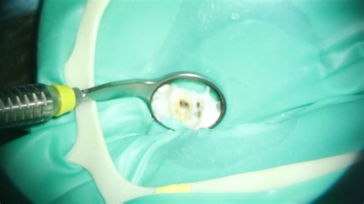 Parafocality 2: big to small