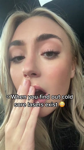 Exploring Cold Sore Laser Treatment: A Shocking Revelation