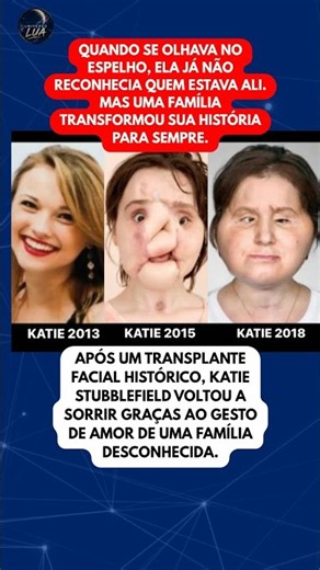 Ela ganhou um novo rosto... e uma segunda chance de viver