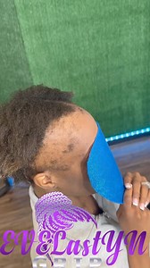 1.6K views · 93K reactions | IM LOCATED IN MARIETTA GEORGIA prosthesis (Cover up style ) layer braids BOOK HERE https://evelastyngrip.com/羅殺 #alopecia braider #alopeciaareataawareness #alopeciatreatment #braidstyles #alopecia #coverupbraids #hairrestoration #hairdresser #HaircareTips https://evelastyngrip.com/c | Evelyn West | Facebook