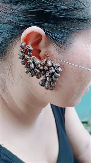 help me please#ticks #scary #ticks #lice #head | Ticks London