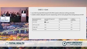 66 y/o With Prostate Adenocarcinoma Who Developed Bone Mets: Expert Panel Case Discussion