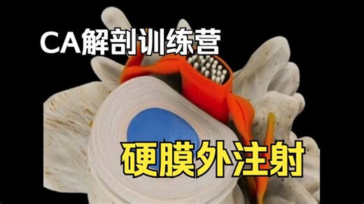 【硬核干货】硬膜外注射 Epidural Injection（中英双语）｜缓解脊椎神经疼痛的方法