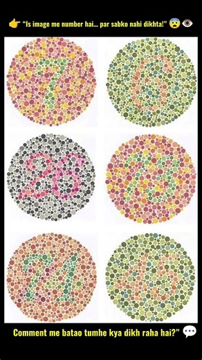 Agar Ye Number Nahi Dikhe 😱 | Colour Blindness Test | #itsmeissie #shortsfeed