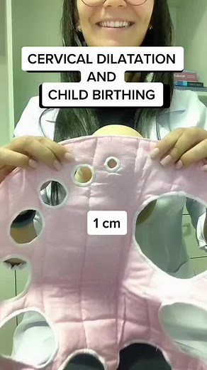 Child Birthing and cerical dilatation 🎥Credit:mbchiarelli.fisio (TT) #viral #fyp #cervical dilatation #midwife #midwifeengineer