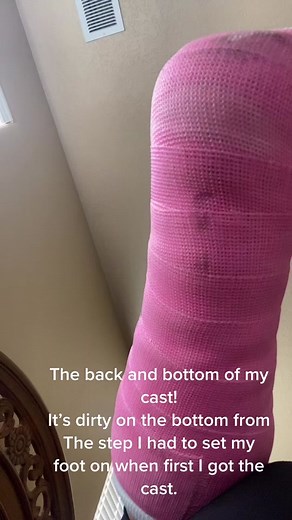 Recovery Tips for a Broken Ankle Surgery | 8 Days in a Pink Cast
