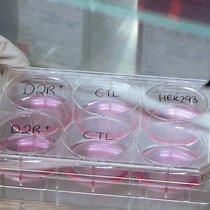 Video: High-throughput Flow Cytometry Cell-based Assay to Detect Antibodies to N-Methyl-D-aspartate Receptor or Dopamine-2 Receptor in Human Serum
