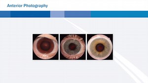 TRC-NW400 Retinal Camera Digital Brochure