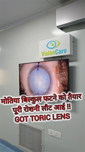 VisionCare Super Speciality Eye Hospital on Instagram: "✨ Clear Vision. Seamless Life. 👁️ Experience the power of EDOF (Extended Depth of Focus) Lens at Visioncare Super Speciality Eye Hospital 🏥 EDOF lenses provide sharp vision at multiple distances, reduced dependence on spectacles 👓, and smooth visual transition—perfect for an active, modern lifestyle 🌈 Our expert eye surgeons use advanced technology to help you enjoy clarity, comfort & confidence every day 💙 📍 Trust your eyes with Visi
