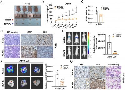 Tumor Suppressor Revealed: NKAPL Halts Lung Cancer Spread by Targeting Key Protein | Newswise