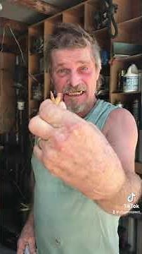 Guy pulls brothers tooth!!!!! MUST WATCH VIDEO!!!!! #tennessee #redneck #funny #funnyvideo