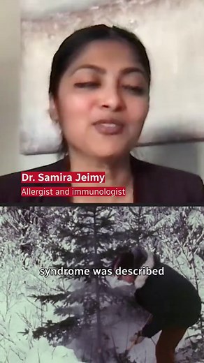 If you start sneezing or getting an itchy rash around Christmas trees, you’re probably not allergic to the holidays. But you might have Christmas Tree Syndrome. Dr. Samira Jeimy, a clinical immunologist and allergist, says pine trees carry allergens like ragweed pollen which can cause flu-like symptoms. Some people may get a rash when they touch pine trees. Dr. Gordon Sussman, also a clinical immunologist and allergist, says that’s likely because of the oleoresins.produced by the tree. While swi