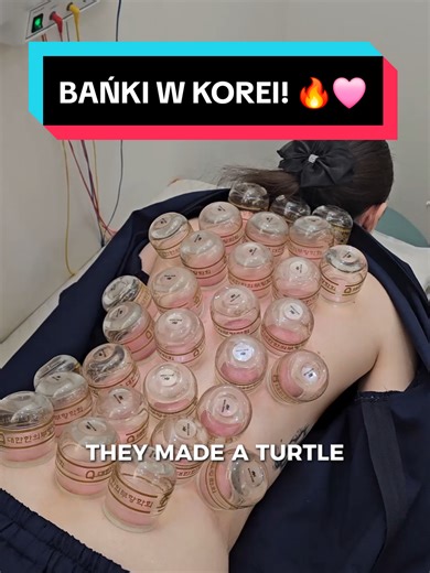 [Zaproszenie] Czasem oprócz twarzy, warto też zadbać o swoje plecy czy inne bóle, więc wybrałam się do @yonghadaclinic aby się tym zająć! ✨️ #kbeauty #khealth #beautyclinic #skincare #korea
