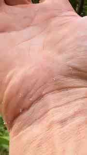 Can a Giant Centipede’s Bite Tear Skin?