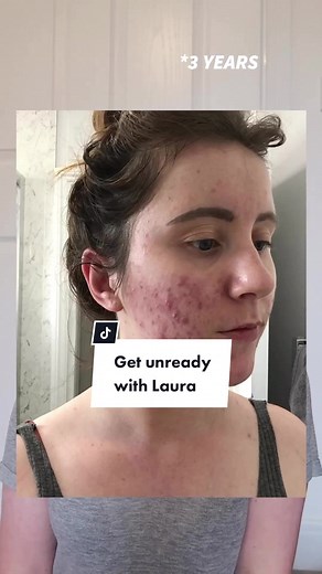 Unlocking Beautiful Skin: Dermatica Treatment Progress