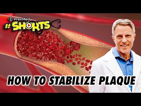 #SHORTS How to Stabilize Plaque