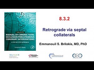 8.3.2: Manual of CTO PCI - Retrograde via septal collaterals