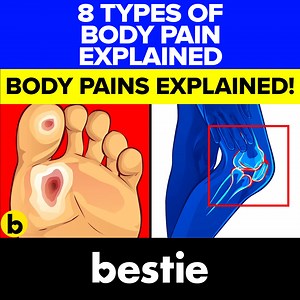 8 Types Of Body Pain Explained #Pain #Health #BodyPain | Bestie