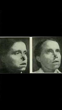 The Radium Girls: The True Story of Women Who Fought Workplace Injustice.