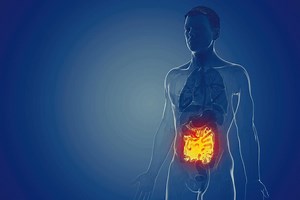 Ulcerative colitis: causes, symptoms and treatment