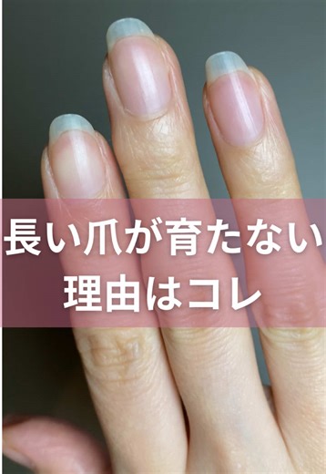 爪が育たない理由と正しい整え方