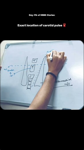 Precise Location of CAROTID PULSE
