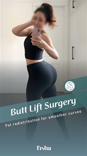 Tisha Clinic - Cosmetic Surgery on Instagram: "💡 What is a BBL? • Brazilian Butt Lift (BBL) is a cosmetic procedure that enhances your natural curves. • Fat is taken from other areas of your body and carefully sculpted to lift and shape the buttocks. • Results are subtle, natural, and tailored to your body type. ⭐ • Recovery includes a few weeks of limited sitting and gentle care for optimal results. • Always consult with a certified surgeon to ensure safety and best outcomes. This visual prese