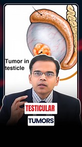 Testicular lumps? Don’t ignore — it could be a tumor! ⚠️ . #TesticularTumor #MensHealthAwareness #SelfCheckMatters #UrologyHealth #TumorAwareness #EarlyDetectionSavesLives #TesticularCancer #HealthAlert #ScrotalLump #MaleWellness | The Ashok Doctor