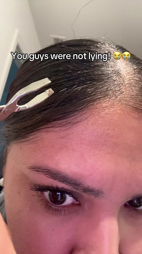 Fast-Growing White Hair: My Experience and Tips