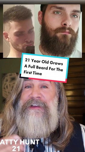 21 Year Old Grows An Epic Full Beard For The First Time