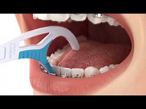 Proxy-Flosser Animation