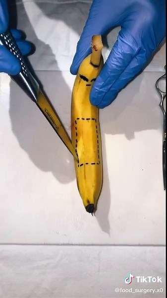 Fruit Surgery Doctor Saves Mrs. Banana's Twins in Knee Surgery Drama