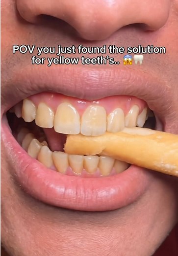 Say Goodbye to Yellow Teeth with Miswak Toothbrush