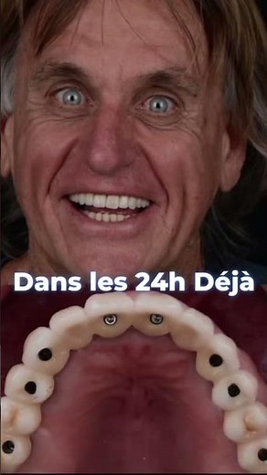 Fini le Dentier ! Passez aux Dents Fixes avec le All-on-6 🦷🇩🇿 (Dr Nabi)