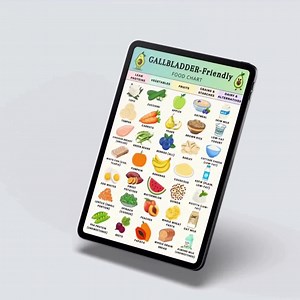 Gallbladder Diet Food Chart PDF, Low Fat Food List, Gallstones Diet Food List, Gallstones & Post Surgery Diet Chart, Low Fat Grocery List - Etsy