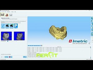 How to scan a model and a wax-up with the Imetric Scanner