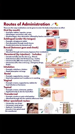 Routes of administration #injection #oralroute