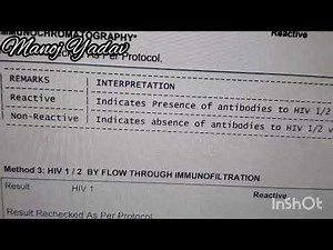 Hiv 1/2 P24 Antibody Test by 3 methods:- 1- P24 Combo , 2 Immunochromatography 3 Immunofilteration