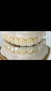 Monet pure zirconia with Highest esthetic! Dr.Andre Jones In Texas! | CEO Luke Kahng
