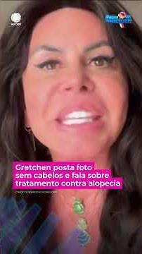 Gretchen posta foto sem cabelos e fala sobre tratamento contra alopecia #ahoradavenenosa #shorts