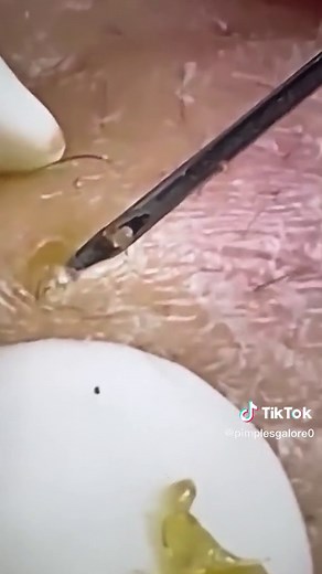 Understanding Red Rash on Skin: Causes and Solutions